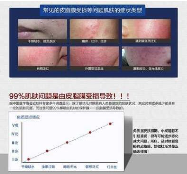 为什么你的脸容易过敏？
