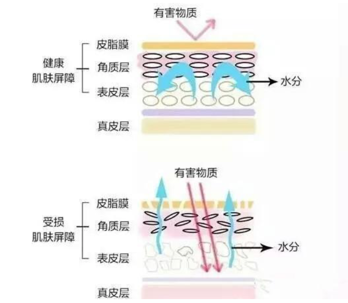 干、痒、红、肿？别慌涂护肤品，先看看皮肤屏